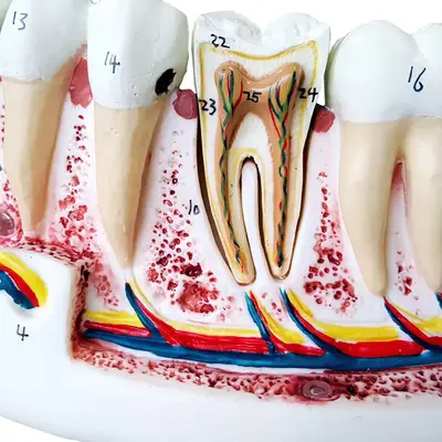 Anatomia do Dente em 6 Partes Modelo Anatomia
