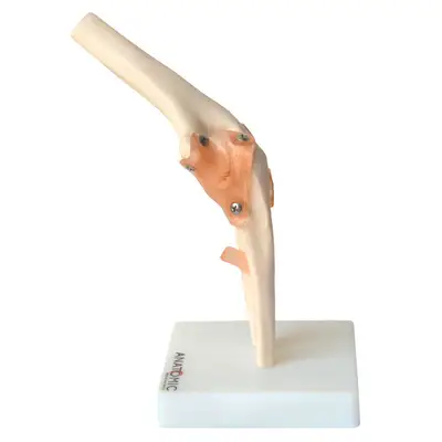 Articulação do Cotovelo com Ligamentos Esqueleto