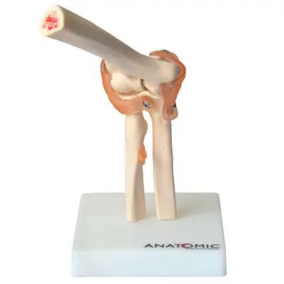 Articulação do Cotovelo com Ligamentos Esqueleto