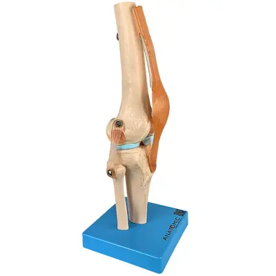 Articulação do Joelho com Ligamentos