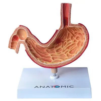 Estômago Humano com Patologias, Anatomia