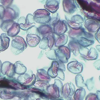 Laminas Preparadas de Botânica 100 peças