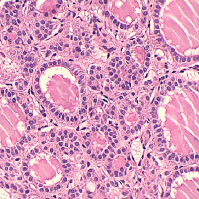 Lâminas Preparadas de Patologia 50 peças