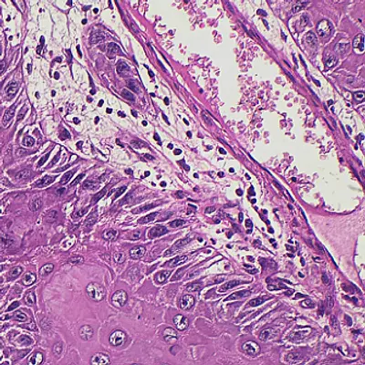 Lâminas Preparadas de Patologia 50 peças