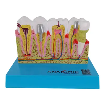 Patologia Dentária e Placa Explicativa em 2 Partes, Anatomia