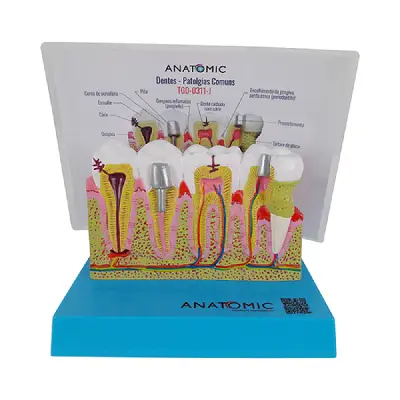Patologia Dentária e Placa Explicativa em 2 Partes, Anatomia