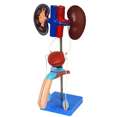 Sistema Urinário Masculino em 6 Partes, Anatomia