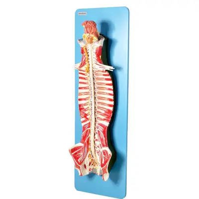Sistema de Medula Espinhal em Prancha, Anatomia