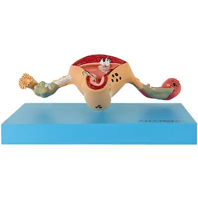Útero com Trompas Patológico em Prancha, Anatomia