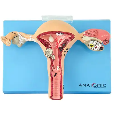 Útero com Trompas Patológico em Prancha, Anatomia