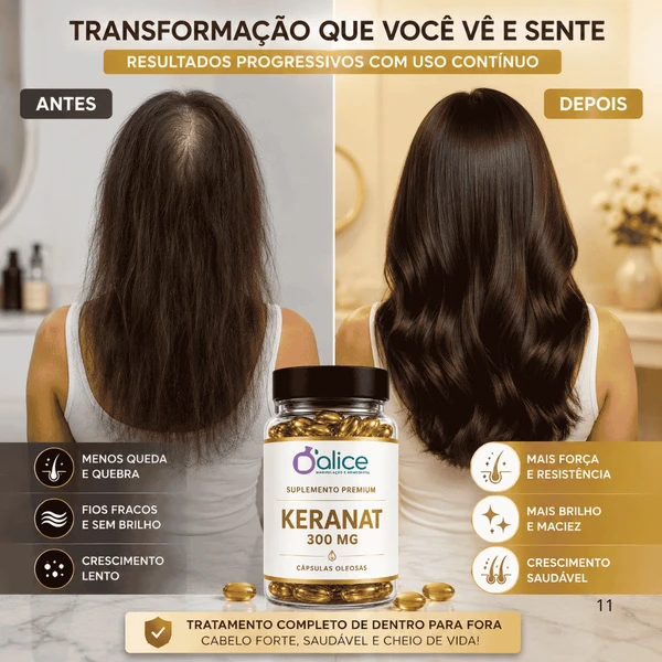 Keranat 300 mg (selo de autenticidade) | Saúde Capilar, Brilho e Fortalecimento dos Fios | 30 Cápsulas Oleosas